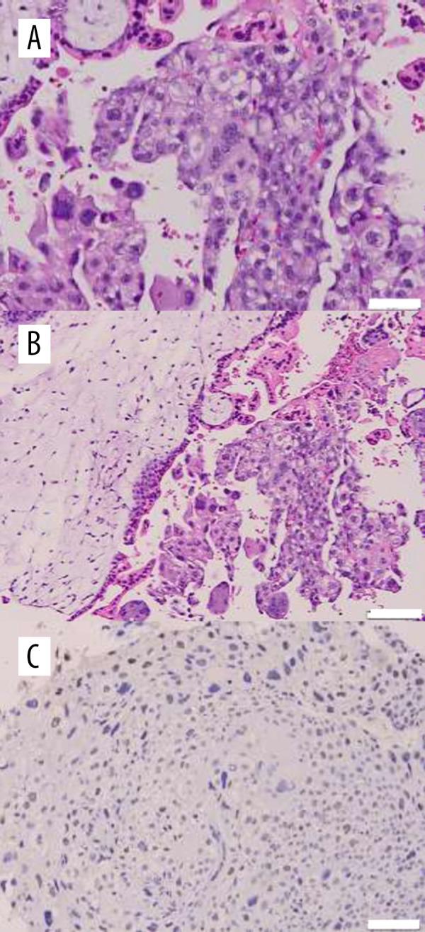 https://cdn.ncbi.nlm.nih.gov/pmc/blobs/c0ef/8126585/1f4037839e9d/amjcaserep-22-e930789-g004.jpg