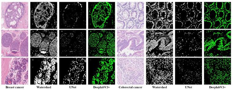 https://cdn.ncbi.nlm.nih.gov/pmc/blobs/c0f0/9311575/1ef5f65ad6c0/biology-11-00982-g007.jpg