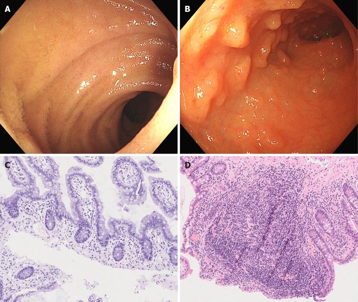 https://cdn.ncbi.nlm.nih.gov/pmc/blobs/c0f5/8900573/d8d3acaa5214/WJG-28-811-g001.jpg