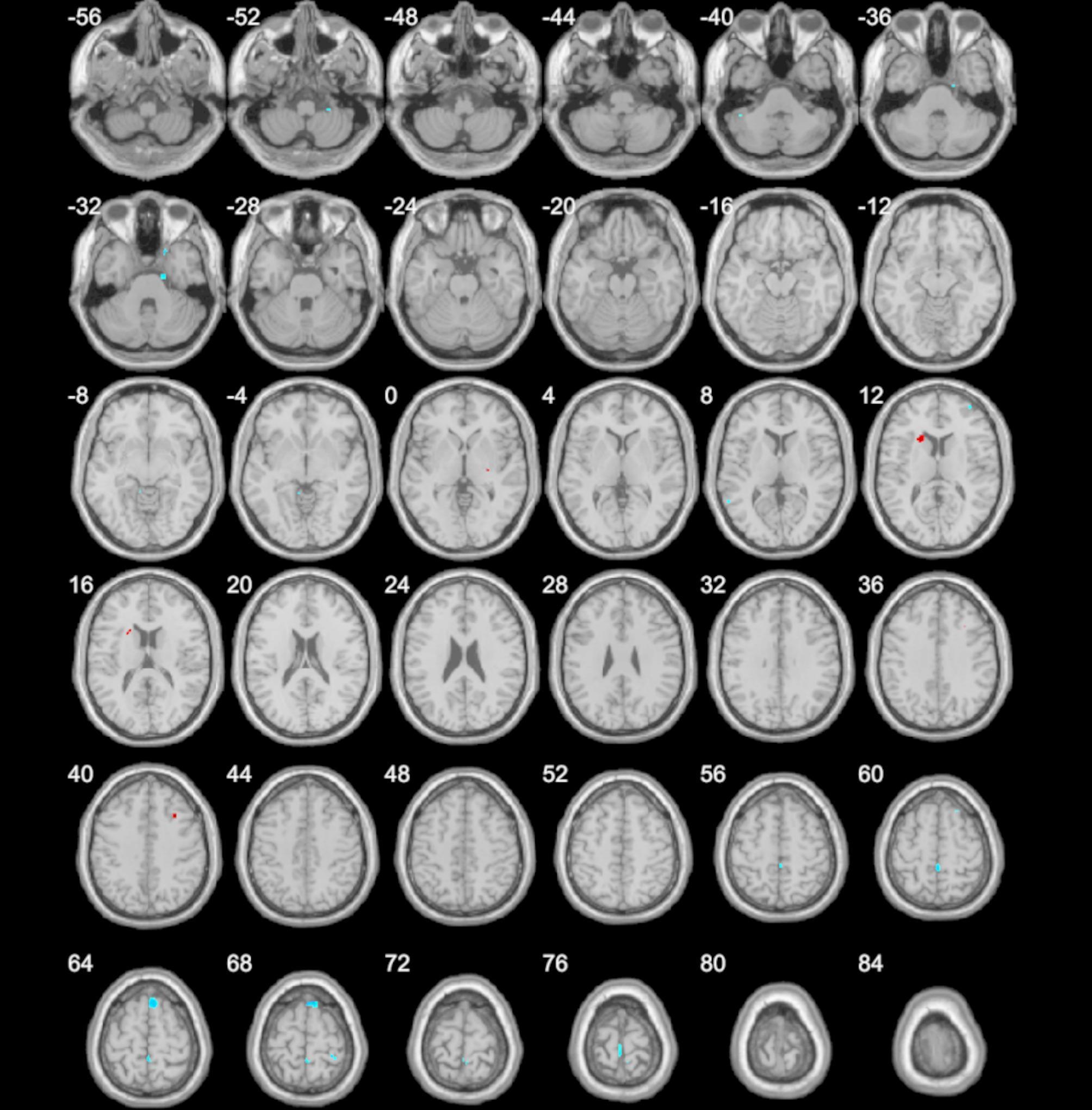 https://cdn.ncbi.nlm.nih.gov/pmc/blobs/c0f7/12070679/afdda575b4f7/12888_2025_6890_Fig3_HTML.jpg