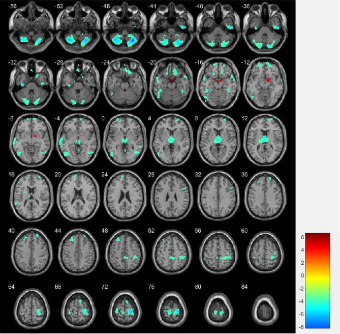 https://cdn.ncbi.nlm.nih.gov/pmc/blobs/c0f7/12070679/c20fd1a5d26b/12888_2025_6890_Fig2_HTML.jpg