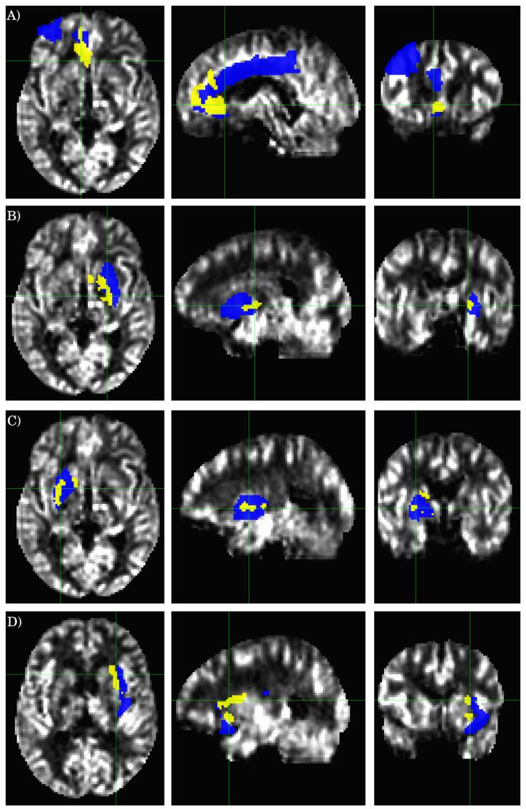 https://cdn.ncbi.nlm.nih.gov/pmc/blobs/c0f9/8628916/b454a10811dd/tomography-07-00056-g003.jpg