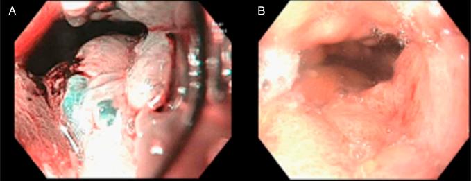 https://cdn.ncbi.nlm.nih.gov/pmc/blobs/c10d/11286243/49ee5316d0a0/ac9-11-e01419-g004.jpg