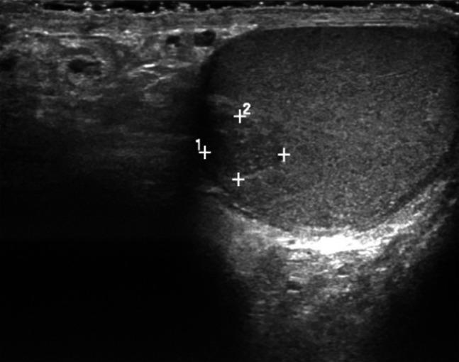 https://cdn.ncbi.nlm.nih.gov/pmc/blobs/c10d/11286243/915d8c3e06d9/ac9-11-e01419-g002.jpg