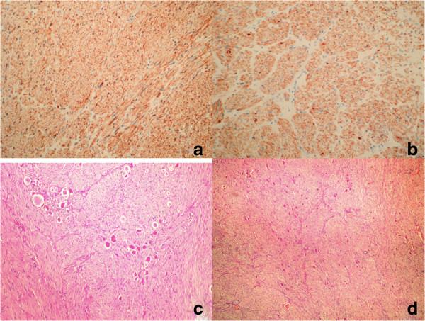 https://cdn.ncbi.nlm.nih.gov/pmc/blobs/c10d/4031973/249896aac7f5/1752-1947-8-131-3.jpg