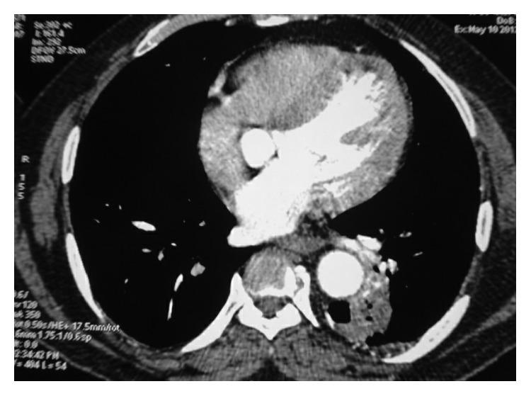 https://cdn.ncbi.nlm.nih.gov/pmc/blobs/c10d/6288572/d056879b7665/CRIID2018-8159896.002.jpg