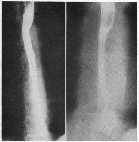 https://cdn.ncbi.nlm.nih.gov/pmc/blobs/c110/1574859/e7021b3dac83/califmed00164-0083-a.jpg