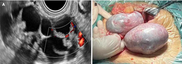 https://cdn.ncbi.nlm.nih.gov/pmc/blobs/c113/11238779/4f3b1540f496/WJCC-12-4932-g001.jpg