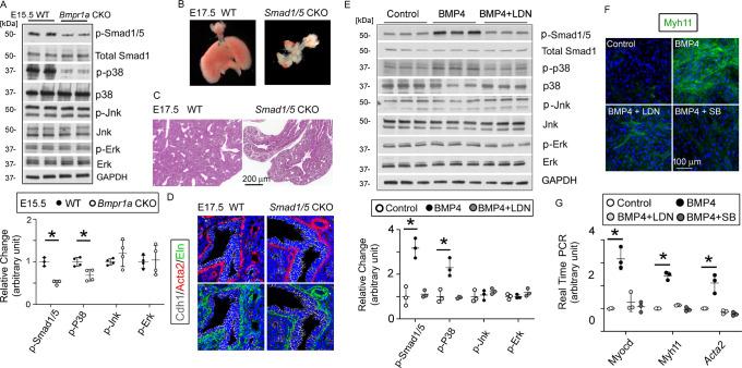 https://cdn.ncbi.nlm.nih.gov/pmc/blobs/c128/11164533/ae74a3ee6092/elife-91876-fig4.jpg