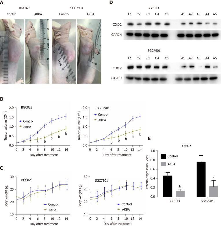 https://cdn.ncbi.nlm.nih.gov/pmc/blobs/c12b/7579763/a41b0e7c9134/WJG-26-5822-g006.jpg