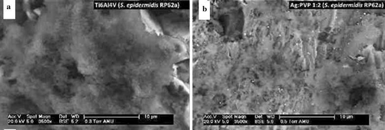 https://cdn.ncbi.nlm.nih.gov/pmc/blobs/c133/4673079/ff38ea47a716/13568_2015_162_Fig6_HTML.jpg