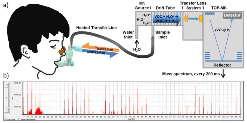https://cdn.ncbi.nlm.nih.gov/pmc/blobs/c135/5948530/8c5f1f6acaf7/sensors-18-00942-g011.jpg