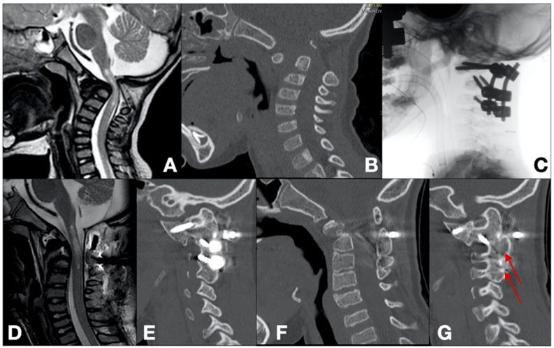 https://cdn.ncbi.nlm.nih.gov/pmc/blobs/c13b/11675030/90b4d3ee17b9/brainsci-14-01228-g002.jpg