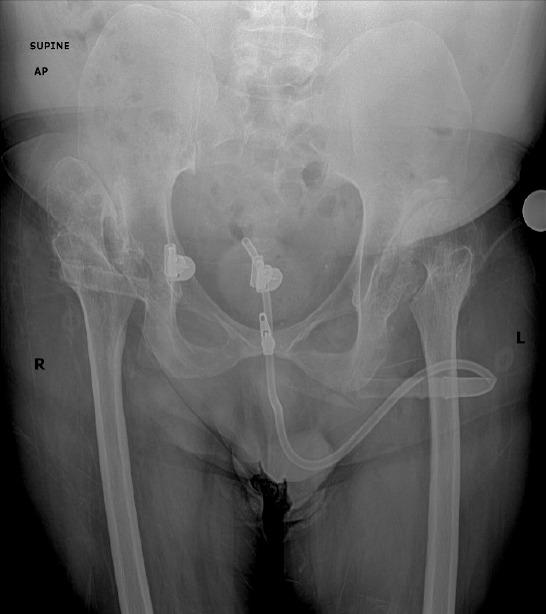 https://cdn.ncbi.nlm.nih.gov/pmc/blobs/c144/11111242/b20586ca18ee/JOCR-14-78-g002.jpg