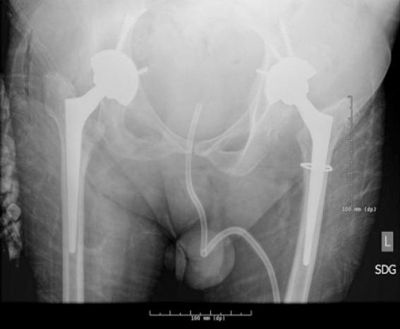 https://cdn.ncbi.nlm.nih.gov/pmc/blobs/c144/11111242/f75c87beda50/JOCR-14-78-g004.jpg