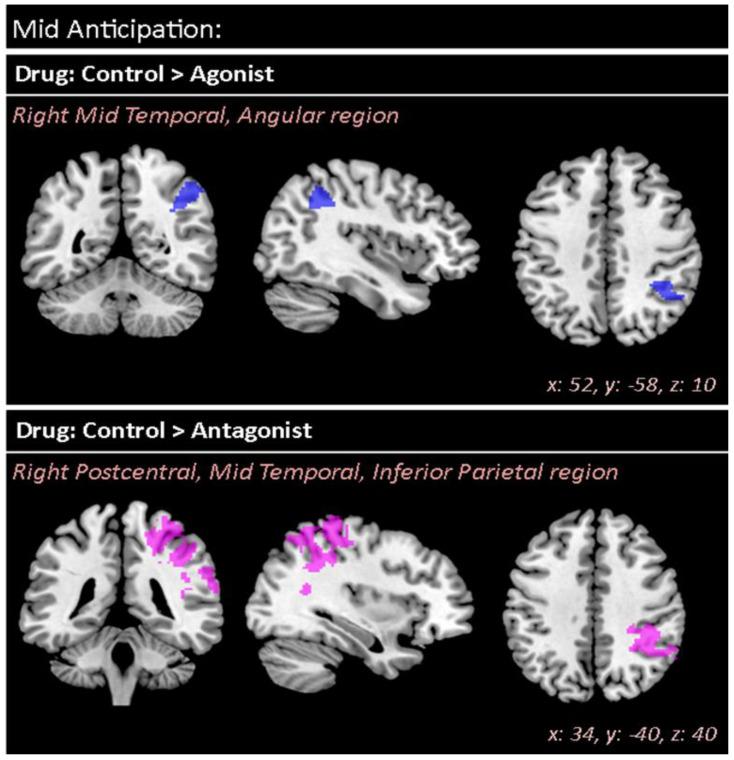 https://cdn.ncbi.nlm.nih.gov/pmc/blobs/c144/8946836/bd2de5c89be6/brainsci-12-00351-g003.jpg