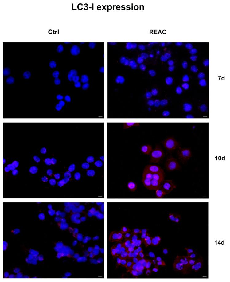 https://cdn.ncbi.nlm.nih.gov/pmc/blobs/c146/10302048/5741cf83980d/jpm-13-01019-g009.jpg
