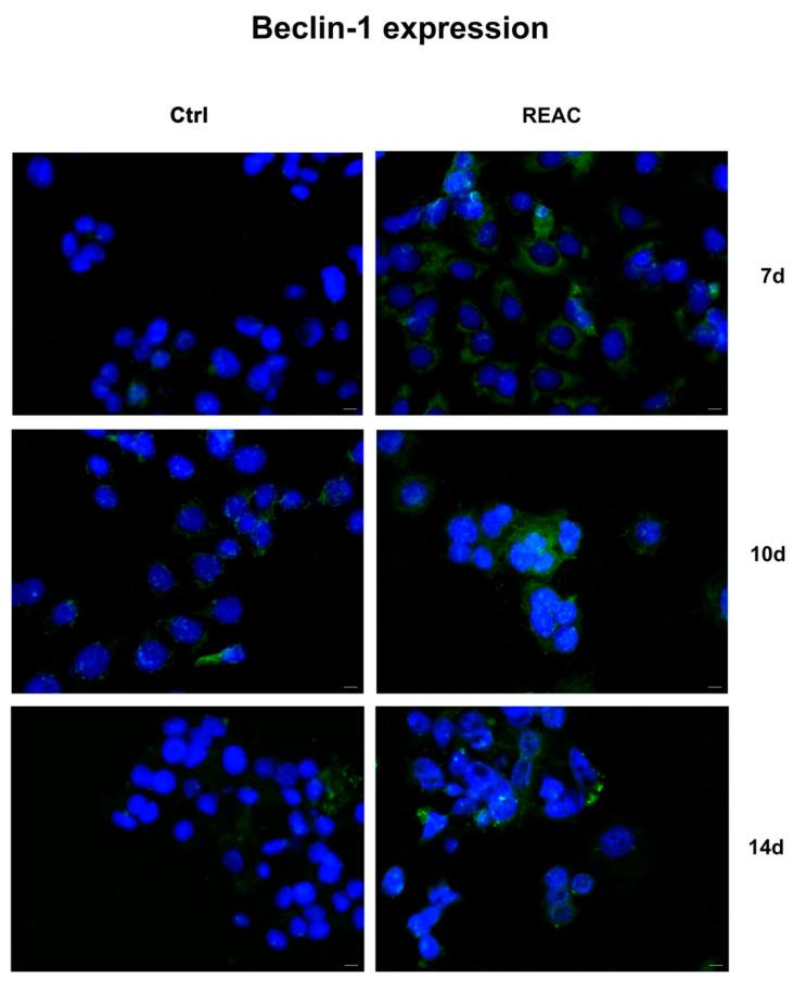 https://cdn.ncbi.nlm.nih.gov/pmc/blobs/c146/10302048/8e95c1bde061/jpm-13-01019-g008.jpg