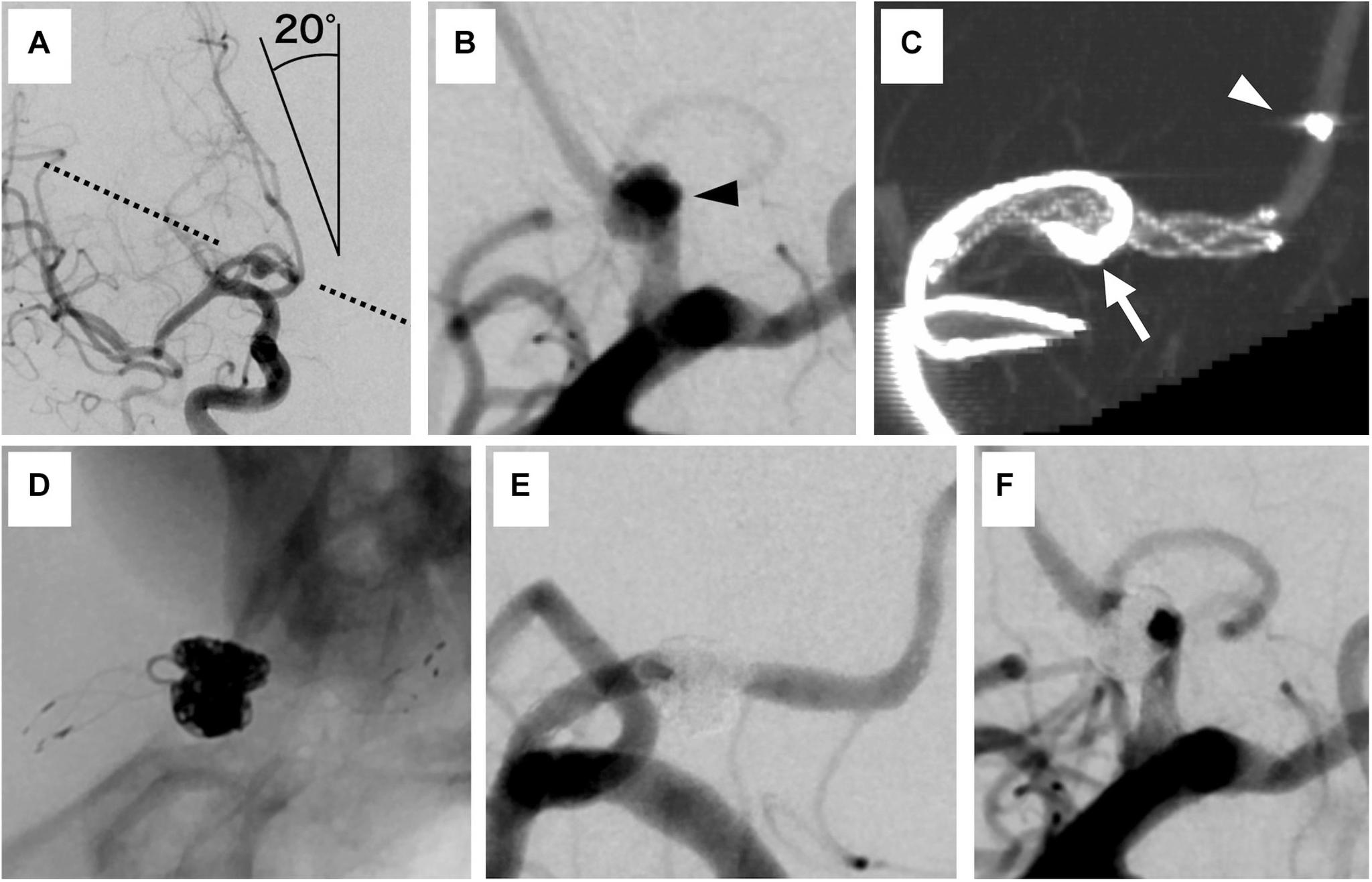 https://cdn.ncbi.nlm.nih.gov/pmc/blobs/c14b/10370535/03ab5bb31fee/jnet-14-435-g002.jpg