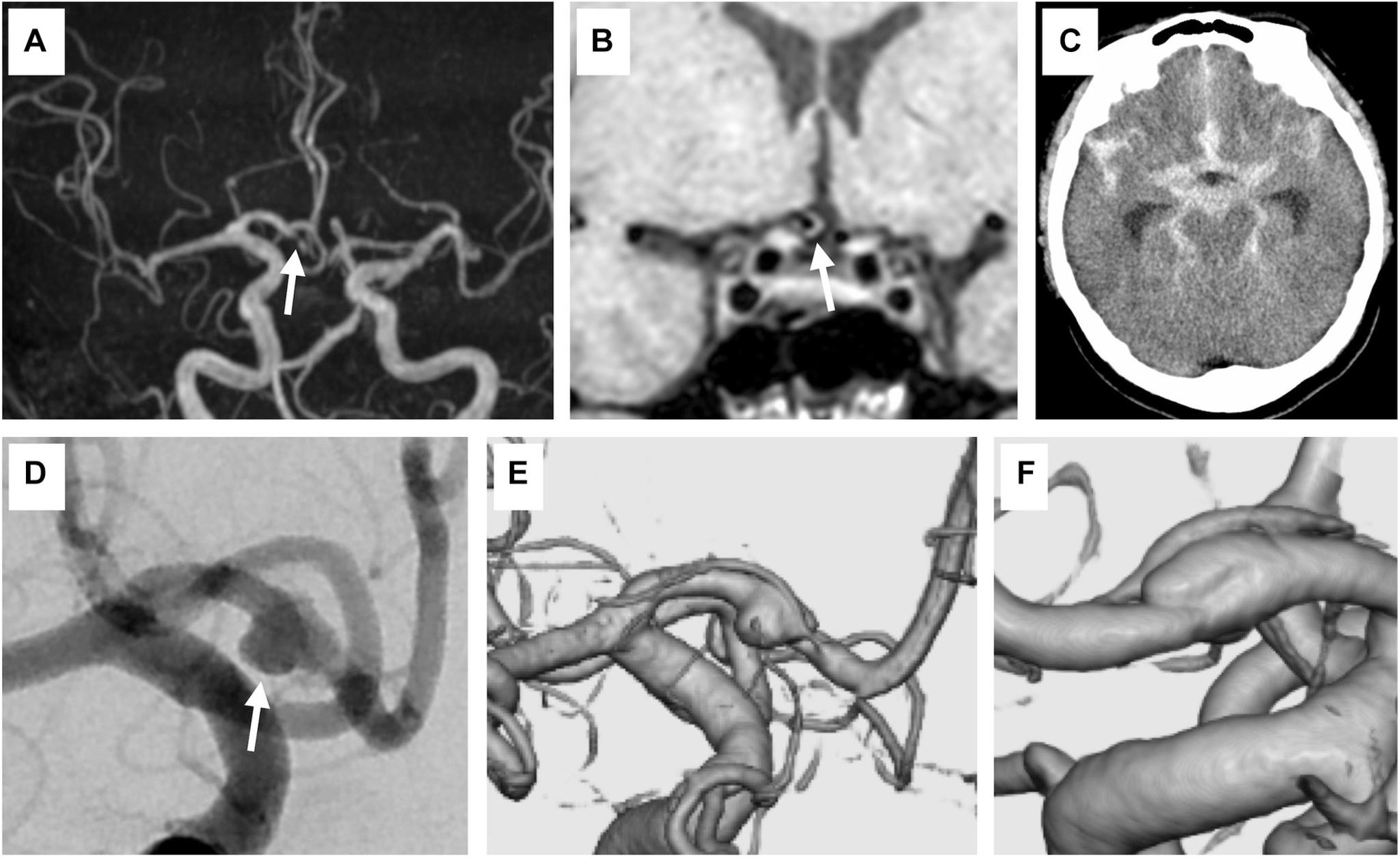 https://cdn.ncbi.nlm.nih.gov/pmc/blobs/c14b/10370535/52ba86419a67/jnet-14-435-g001.jpg