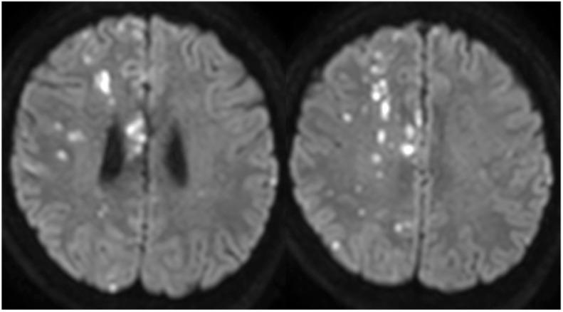 https://cdn.ncbi.nlm.nih.gov/pmc/blobs/c14b/10370535/8b3d110d6ea0/jnet-14-435-g003.jpg