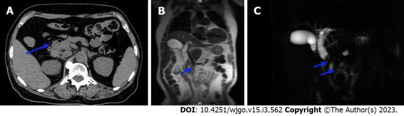https://cdn.ncbi.nlm.nih.gov/pmc/blobs/c14c/10052659/484eac5bc4db/WJGO-15-562-g001.jpg