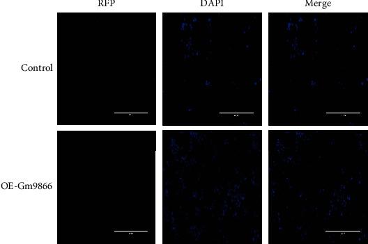 https://cdn.ncbi.nlm.nih.gov/pmc/blobs/c14d/9899594/6f10be7c9a8d/MI2023-9991916.005.jpg