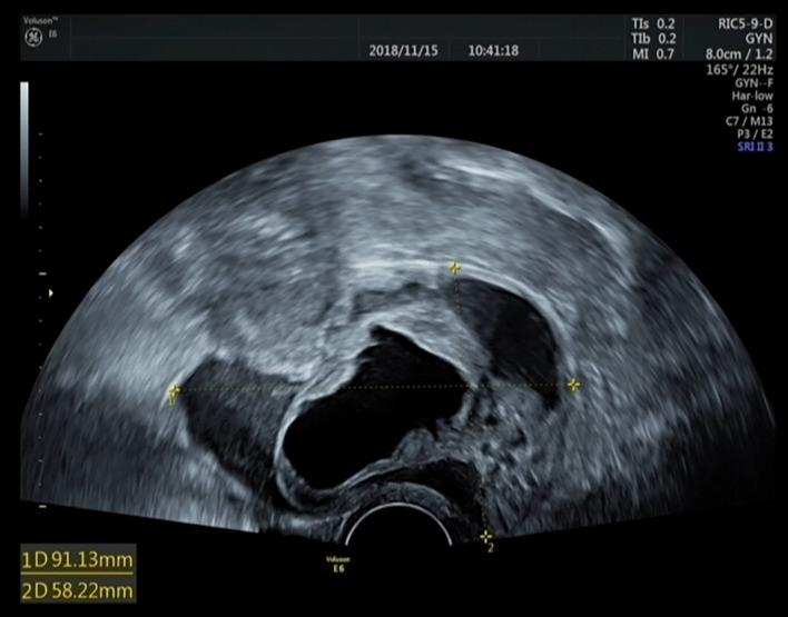 https://cdn.ncbi.nlm.nih.gov/pmc/blobs/c158/9846607/07c728740c7e/fonc-12-1064851-g001.jpg