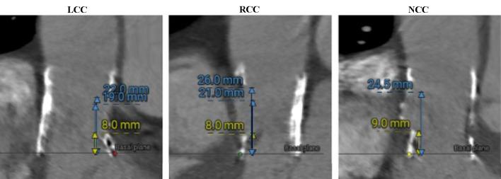 https://cdn.ncbi.nlm.nih.gov/pmc/blobs/c15a/11779679/4ddcf7512791/cr-16-072-g003.jpg