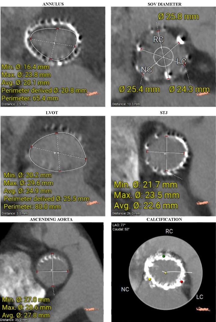 https://cdn.ncbi.nlm.nih.gov/pmc/blobs/c15a/11779679/a3b36b18b42d/cr-16-072-g002.jpg
