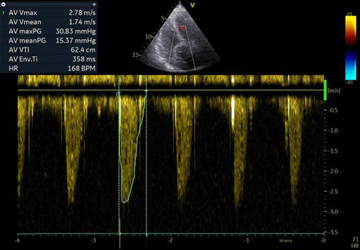 https://cdn.ncbi.nlm.nih.gov/pmc/blobs/c15a/11779679/d0bdd0640211/cr-16-072-g007.jpg