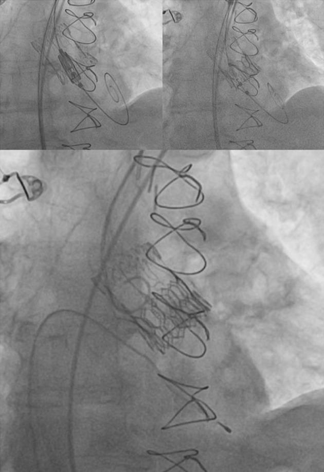 https://cdn.ncbi.nlm.nih.gov/pmc/blobs/c15a/11779679/d5023b5fd881/cr-16-072-g006.jpg