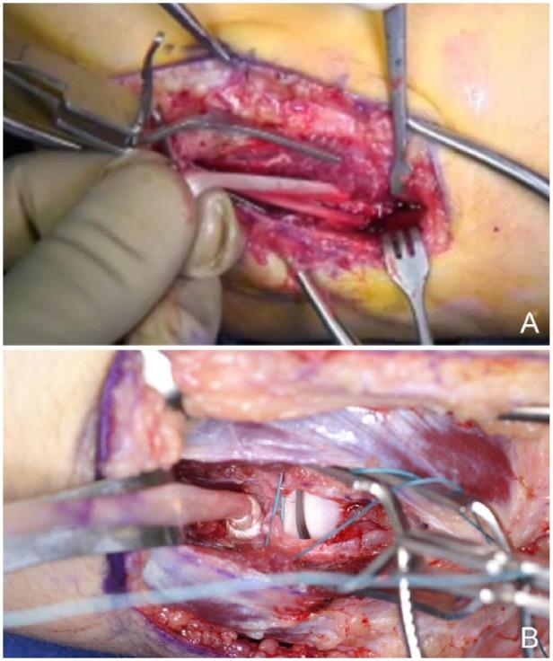 https://cdn.ncbi.nlm.nih.gov/pmc/blobs/c15c/4622381/06e9489b41f1/10.1177_1941738115607208-fig5.jpg