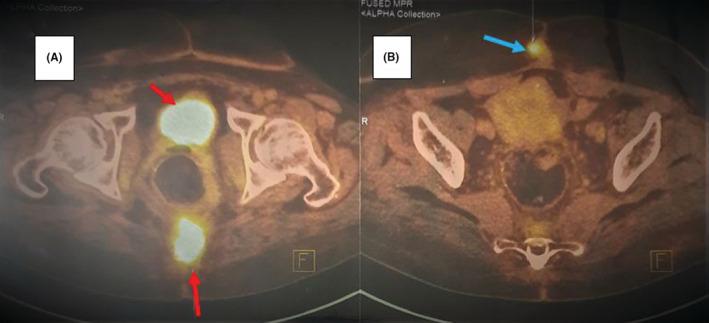 https://cdn.ncbi.nlm.nih.gov/pmc/blobs/c161/9900233/babca56f1e69/CCR3-11-e6893-g002.jpg