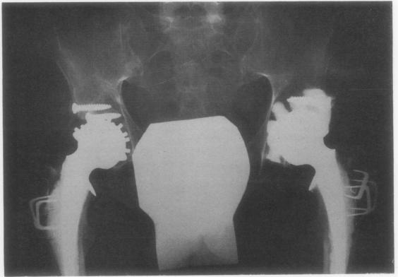 https://cdn.ncbi.nlm.nih.gov/pmc/blobs/c162/1031214/6fc8f63f0318/annrheumd00240-0010-a.jpg