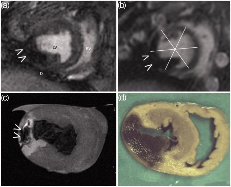 https://cdn.ncbi.nlm.nih.gov/pmc/blobs/c16f/5544151/af4a7ff1020a/10.1177_2058460117718407-fig1.jpg