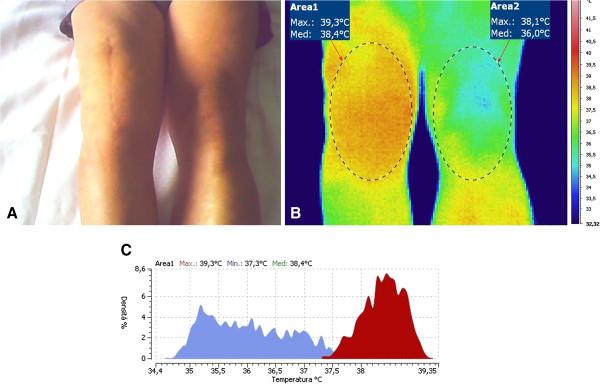 https://cdn.ncbi.nlm.nih.gov/pmc/blobs/c174/3565984/869481007e4e/1471-2474-14-7-1.jpg