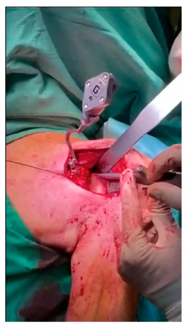 https://cdn.ncbi.nlm.nih.gov/pmc/blobs/c17e/12028824/528797d6459c/medicina-61-00749-g002.jpg