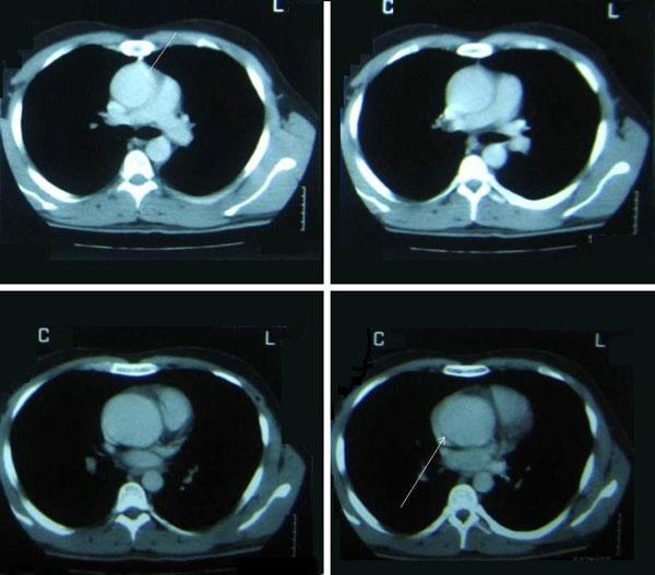 https://cdn.ncbi.nlm.nih.gov/pmc/blobs/c181/2827126/97a4d415b88b/1757-1626-0002-0000007076-2.jpg