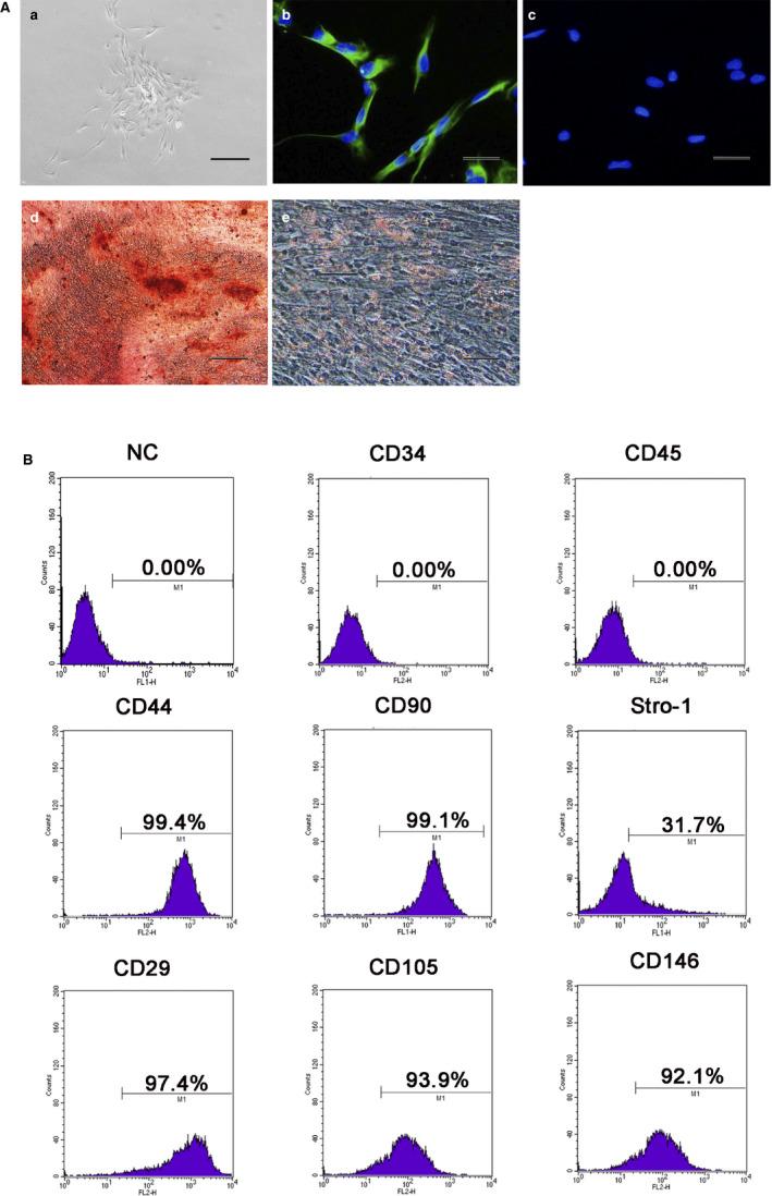 https://cdn.ncbi.nlm.nih.gov/pmc/blobs/c185/7521281/feaaee0274a7/JCMM-24-10621-g001.jpg