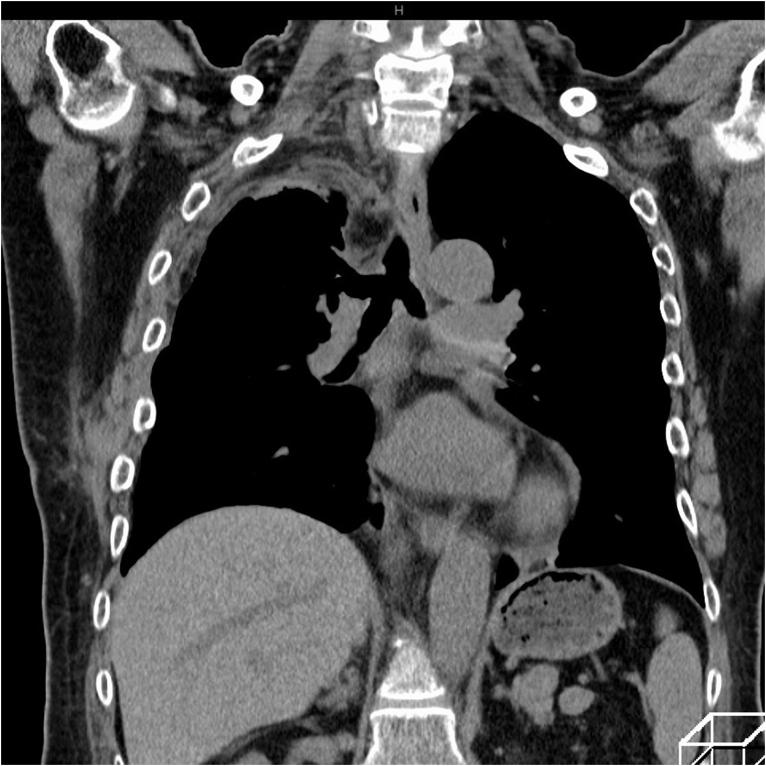 https://cdn.ncbi.nlm.nih.gov/pmc/blobs/c191/10439302/75d58c7411bd/gr5.jpg