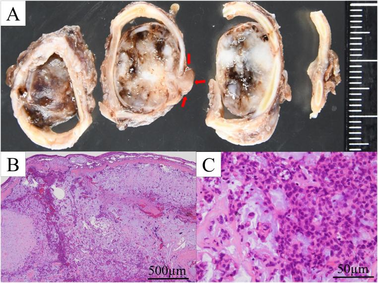 https://cdn.ncbi.nlm.nih.gov/pmc/blobs/c191/10439302/9e5bebbf63dc/gr6.jpg
