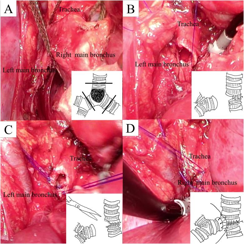 https://cdn.ncbi.nlm.nih.gov/pmc/blobs/c191/10439302/a3d411ae729b/gr4.jpg
