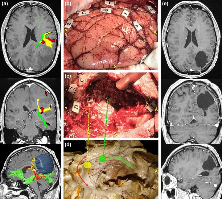 https://cdn.ncbi.nlm.nih.gov/pmc/blobs/c191/10454270/0eedd38cb866/BRB3-13-e3107-g002.jpg