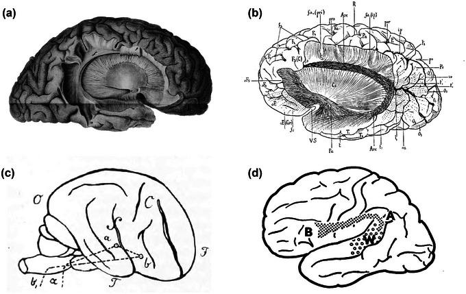 https://cdn.ncbi.nlm.nih.gov/pmc/blobs/c191/10454270/9349cefd447e/BRB3-13-e3107-g008.jpg