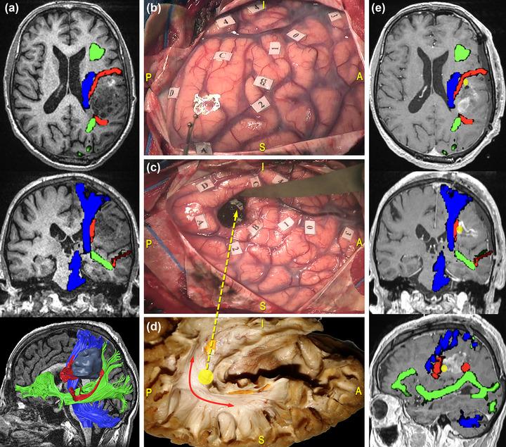 https://cdn.ncbi.nlm.nih.gov/pmc/blobs/c191/10454270/f0b6c9b6e231/BRB3-13-e3107-g003.jpg