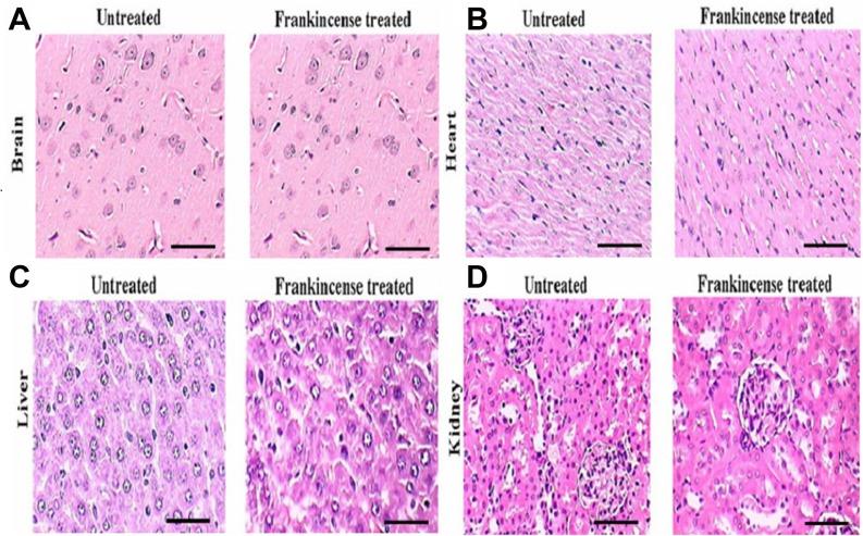 https://cdn.ncbi.nlm.nih.gov/pmc/blobs/c191/6544398/a362bec8280a/oncotarget-10-3472-g007.jpg