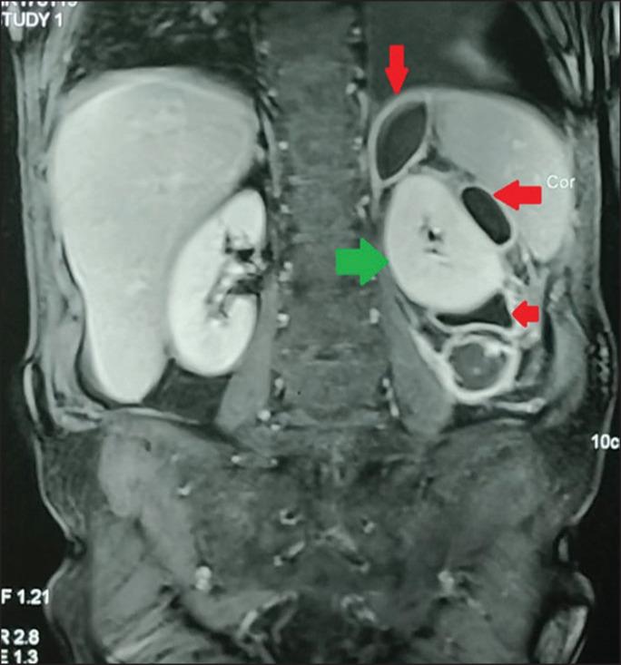 https://cdn.ncbi.nlm.nih.gov/pmc/blobs/c19b/10866256/ea4d677369e7/JFMPC-12-3418-g002.jpg