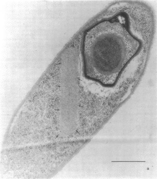 https://cdn.ncbi.nlm.nih.gov/pmc/blobs/c1a3/251847/73b2c89b25d3/jbacter00351-0408-a.jpg