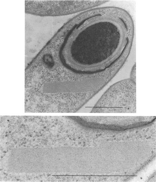 https://cdn.ncbi.nlm.nih.gov/pmc/blobs/c1a3/251847/7dc3b132b670/jbacter00351-0405-a.jpg